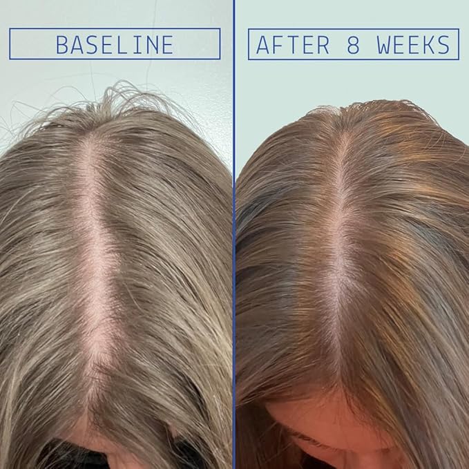 AAVRANI Hair Density Boosting Treatment - Ashwagandha, Vegan Collagen, And Turmeric Scalp Serum For Thicker, Fuller Hair - Vegan, Non-Greasy - 2 Fl Oz