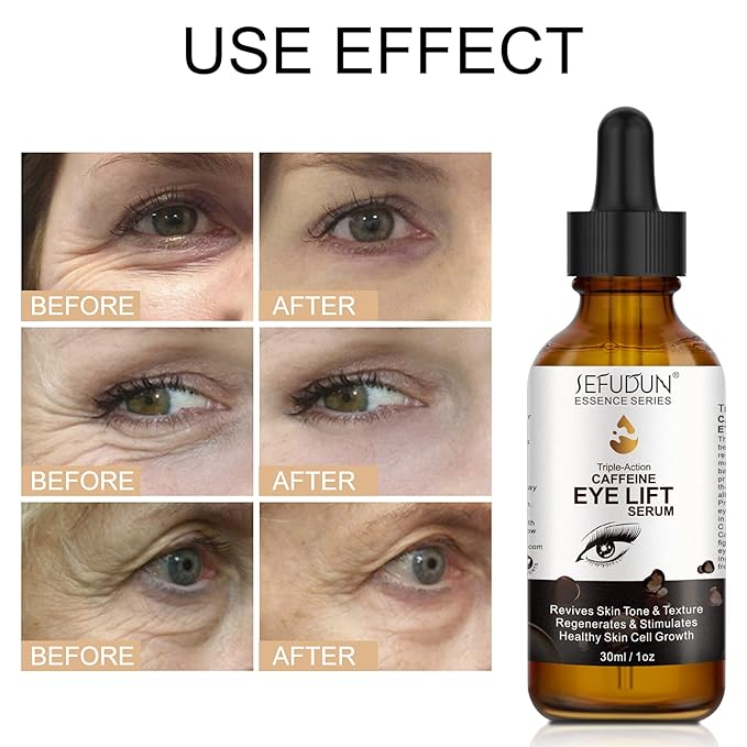 Dark Circles Under Eye Treatment for Women Caffeine Serum Circles, Puffiness, Bags, Anti Aging Reduces Wrinkles and Fine Line, 100% Pure Coffee Oil - 1 oz / 30 ml, 1 Fl Oz (Pack of 1)