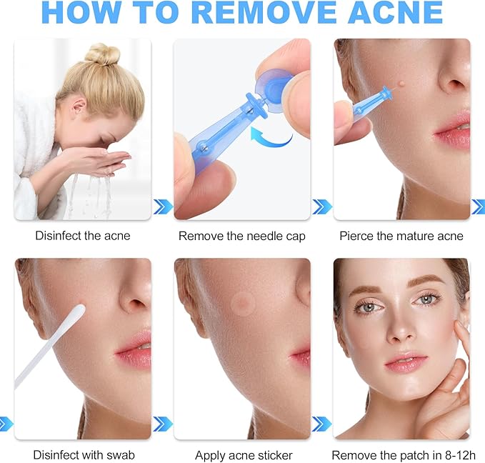 100PCS Disposable Acne Needle & 144 Dots Pimple Stickers - Ultrafine Pimple Popper Needle