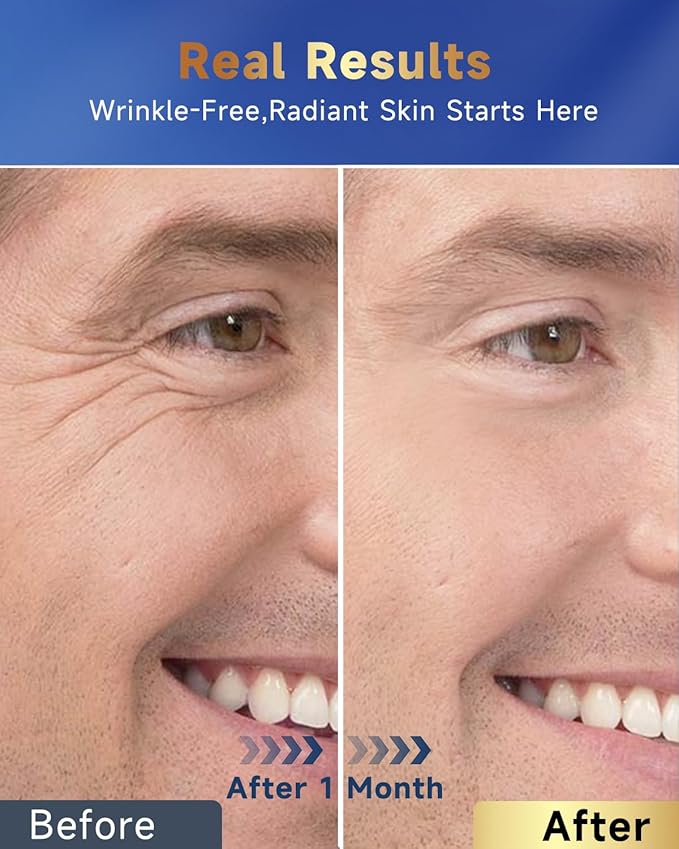 6-in-1 Face Cream for Men, Mens Face Moisturizer, Anti-Aging Face Cream for Men with Retinol Collagen & Hyaluronic Acid, Eye Bags & Dark Spot Remover, After Shave Lotion 1.7 Fl Oz