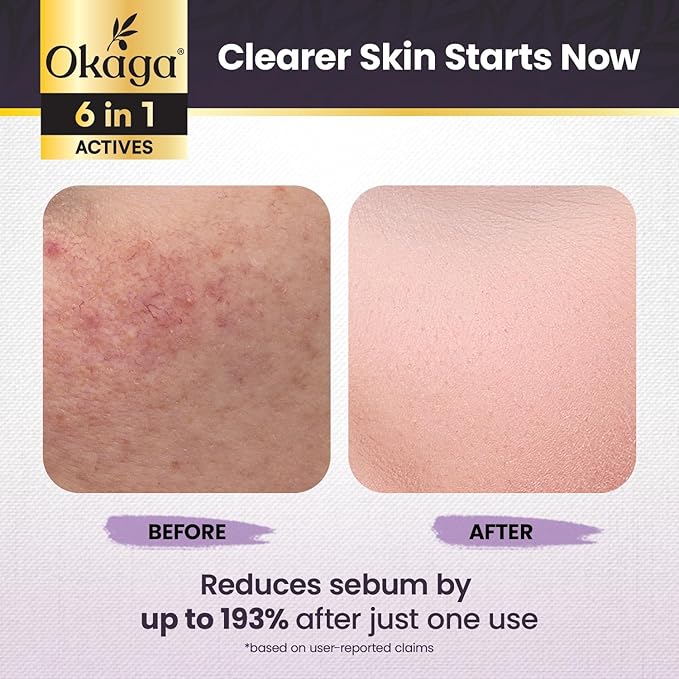 Black Rice Exfoliant Rice Peel Shot Ampoule - Removes Sebum, Dead Skin, Rice Exfoliator for Face - Pore Minimizer and Hydrating Formula for Smooth Radiant Glow, All Skin Types (90 mL)