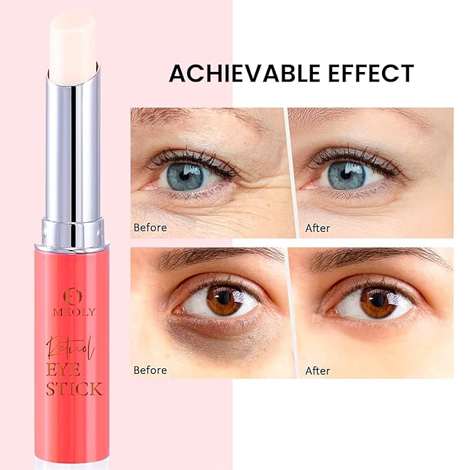 Retinol Under Eye Stick Balm: Cooling Eye Cream for Dark Circles Fine Lines Puffiness, Anti Wrinkle Hydrating Face Skincare in 3-4 Weeks