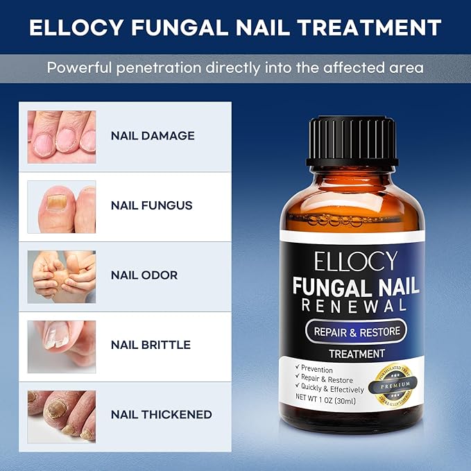 Toenail Fungus Treatment Extra Strength: