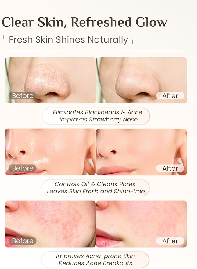 Rena Chris 3 Pcs Silicone Face Scrubber, 3 in 1 Face Mask Applicator & Facial Cleansing Brush, Pore Brush for Exfoliating, Blackhead, Skincare Applicator Tools