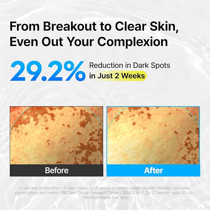 MANYO Galac Niacin 3.0 Essence Korean Facial Serum, Ultra Hydrating, Tone Balancing, Niacinamide, for Women and Men Korean Skin care 2.02 fl oz (60ml)