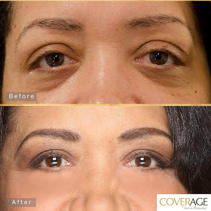 Jerome Alexander CoverAge Concealer Stick - Anti-Aging Under Eye Concealer + Skincare - Brighten Dark Circles, Hydrate, and Nourish - Medium Dark