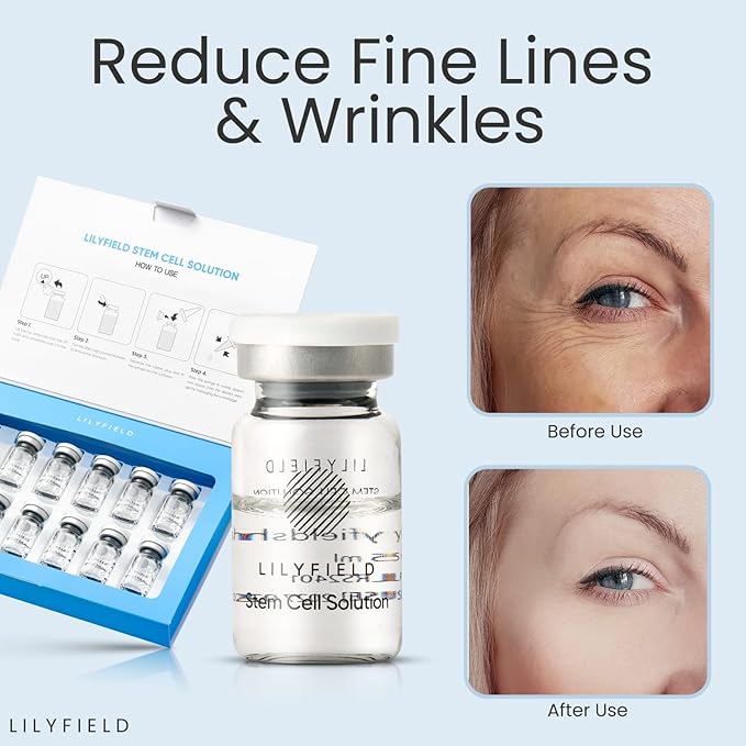 LILYFIELD Stem Cell Solution 50ml (5ml x 10 Ampoules) – Hydrating Hyaluronic Acid Serum with Stem Cells, Peptides & Vitamin C | Korean Skincare for Moisturized, Smoother-Looking Skin, All Skin Types