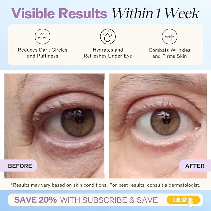 LilyAna Naturals Eye Cream for Dark Circles and Puffiness, Under Eye Cream for Wrinkles and Bags, Anti Aging helps Improve Dryness; for Sensitive Skin (1.7 Ounce, Pack of 2)