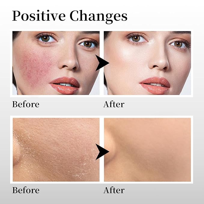 Beef Tallow for Skin Made in USA, Grass-Fed Beef Tallow for Face, Quick Absorbing, Hydrating Tallow Face Moisturizer, Whipped Beef Tallow and Honey Balm for Face&Body,Beef Tallow Cream(2oz. Unscented)