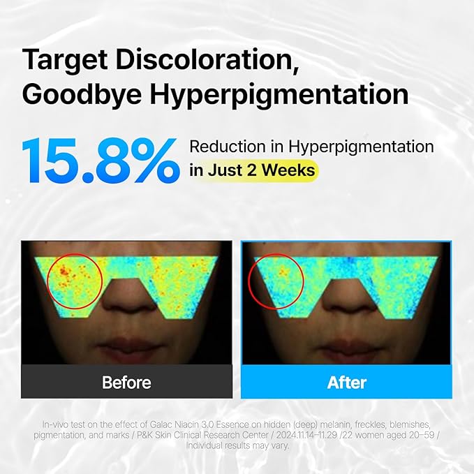 MANYO Galac Niacin 3.0 Essence Korean Facial Serum, Ultra Hydrating, Tone Balancing, Niacinamide, for Women and Men Korean Skin care 2.02 fl oz (60ml)