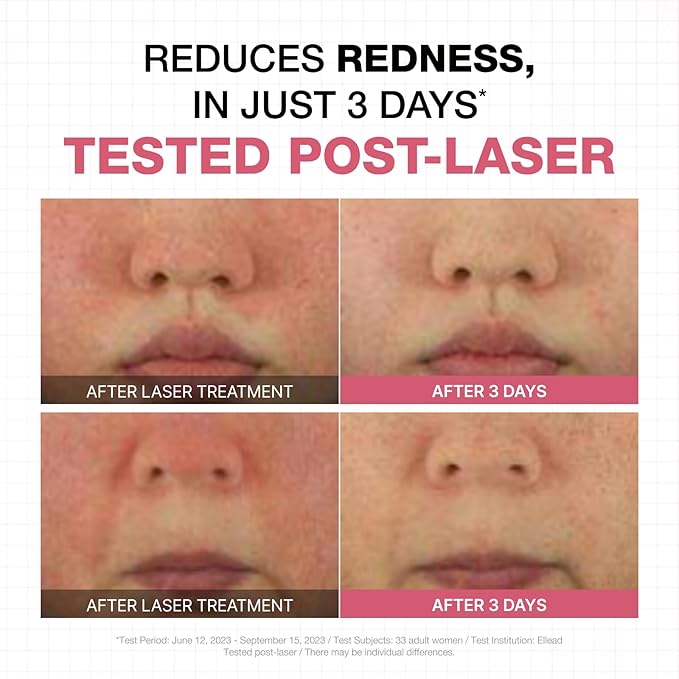 Physiogel Moisturizer Cream, Reduces Redness in just 3 days, Hydration for Dry & Sensitive Skin, Korean skin care, Fragrance-Free, Non-Comedogenic, Dermatologist-Tested, Ceramide Night Cream.