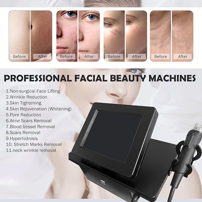 Portable Effective Home Beauty Equipment,Promote Skin Metabolism, Brighten and Tighten Skin Machine