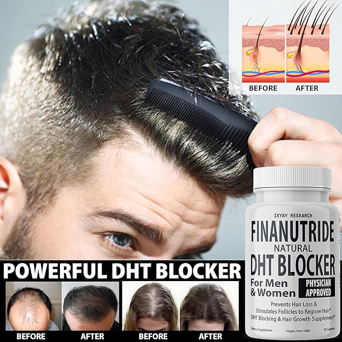 Finanutride Natural DHT Blocker & Hair Growth Capsules - Prevent Hair Loss, Stimulate Follicles, Proprietary Regrowth Treatment