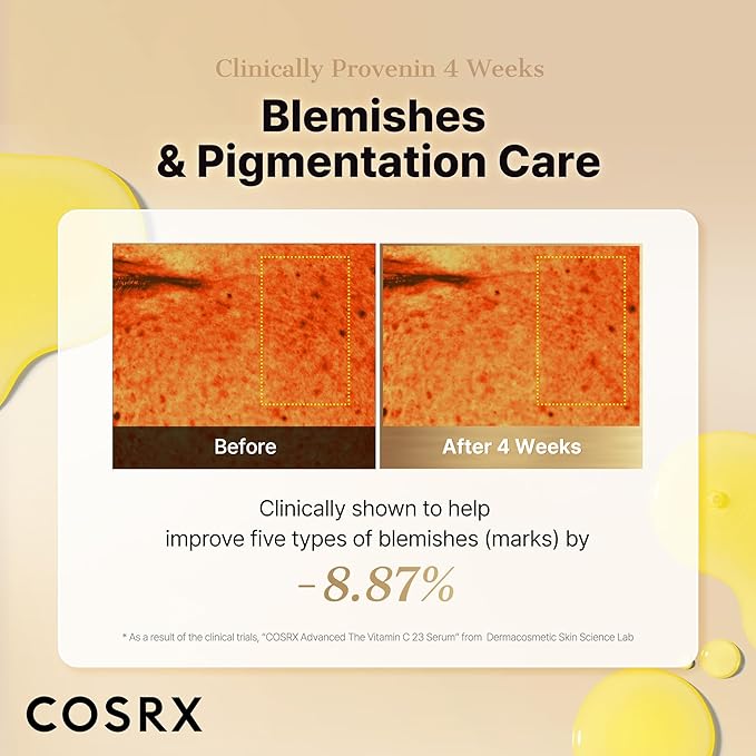 COSRX Advanced Pure Vitamin C 23% Serum with Vitamin E & Glutathione (Renewal), Korean Vitamin C Serum for Fine Lines, Uneven Skin Tone & Dull Skin, 0.67oz, Korean Skin Care, Stocking stuffers