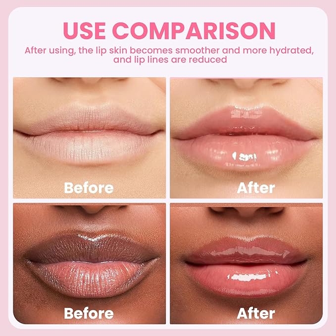 4 PCS Lip Scrub and Mask Set, Strawberry Watermelon Lip Exfoliator Scrub, Moisturizing Lip Balm for Dry Lips, Reduce Lip Lines