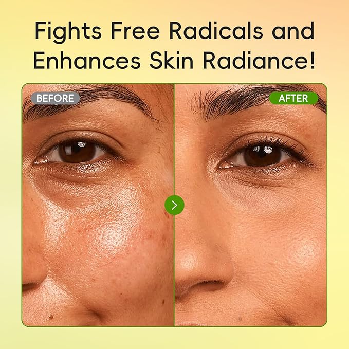 Skin Care Set for Oily/Combination Ance Skin, 5PCS Natural Fruit Skincare Kit with Salicylic Acid, Vit-C & Peptide, Birthday Gifts for Women | Oil Control | Brightening | Anti-Acne | Gift Sets