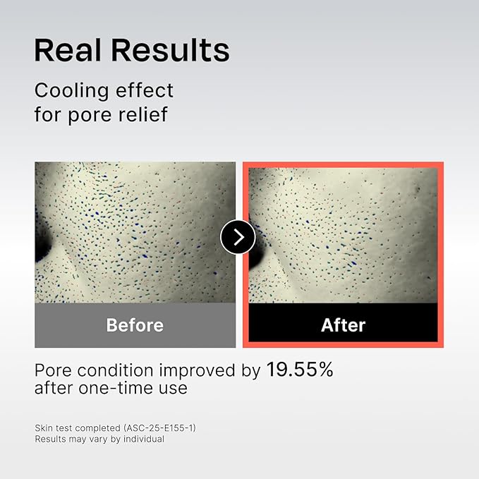 Celladix 131 Hyaluronic Cooling Toner, Korean Skincare Facial Toner with Panthenol, Squalane & Botanical Complex- Instant Soothing, Hydrating & Oil Control for Sensitive & Acne-Prone Skin, 10.1 Fl Oz