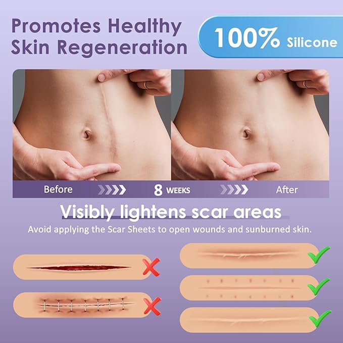 Clear Silicone Scar Sheets - 1.6"