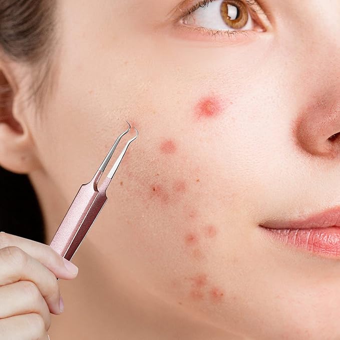 Honoson 3 Pcs Blackhead Tweezer Stainless Steel Pimple Tweezers Extractor Tool for Remove Zit Whitehead Pimple Bend Curved Tweezer Skin Blackhead Remover Tools(Champagne Purple)