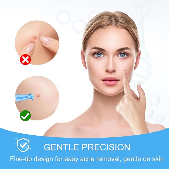 110PCS Disposable Acne Needles, Pimple Popper Tool Kit for Cosmetic Use,Skin Blemish Removal Tool,Convenient for Skincare use at Home and During Travel
