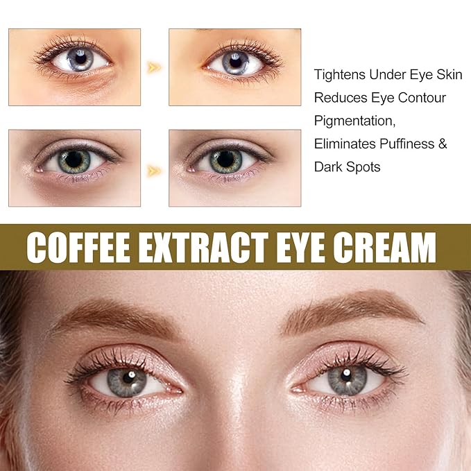 2PCS Caffeine Eye Cream for Dark Circles and Puffiness, Anti-Wrinkle Stay-Up Late Retinol Eye Cream, Tightening & Firming Skin, Dilute Dark Circles