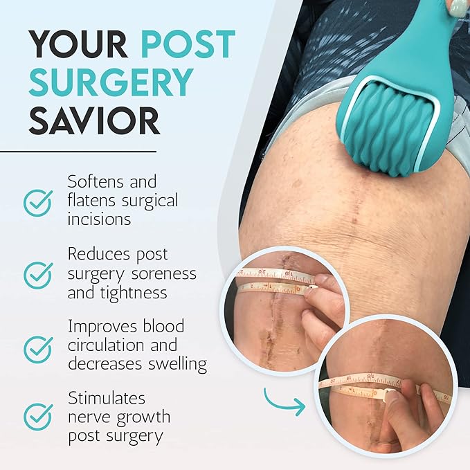 Scar Roller, Scar Tissue Massager for Post-Surgery Recovery, Silicone Ice Massage for Post-Surgery Incision Swelling and Soreness, Joint Roller for Improved Range of Motion and Flexibility. Teal