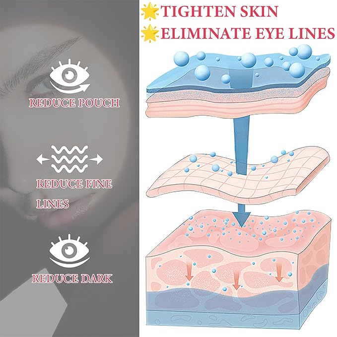 Retinol Eye Cream for Dark Circles and Puffiness,Under Eye Cream with Collagen & Hyaluronic Acid,Fix Wrinkle,Lightweight Lift Eye Cream,Brighten Tighten Eye Cream Gel to Smooth Fine Lines & Hydrate