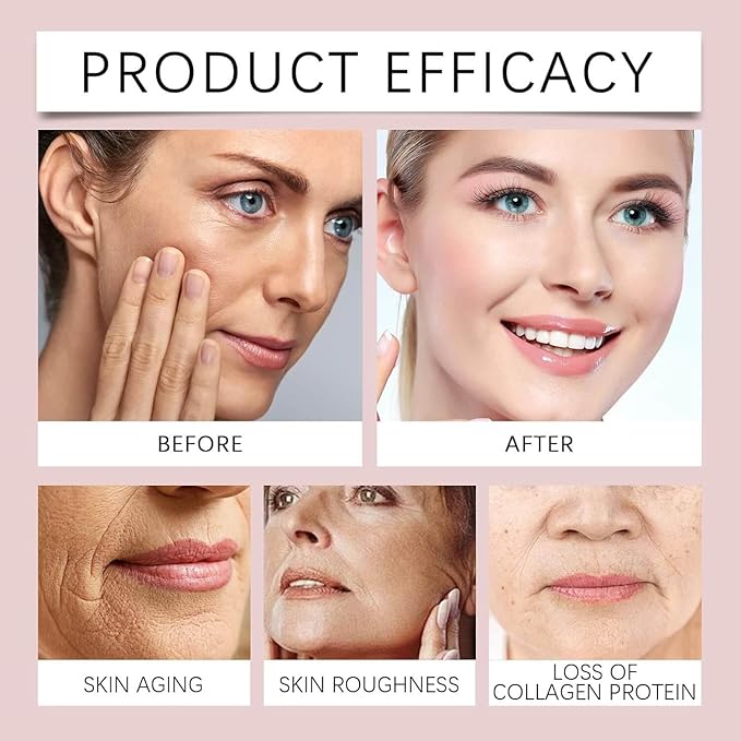 377 Anti Wrinkle Cream for Face, 377 Dark Spot Remover, Moisturizing & Rejuvenating Skin, 40g