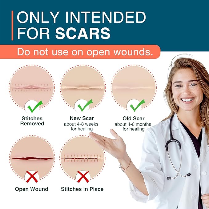 Silicone Scar Sheets, 1.5¡± x 78¡±
