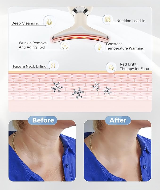 7 Color Face and Neck Massager Light Therapy, Red Light Based Facial Massager for Skin Care, Firming, Smoothing (White)