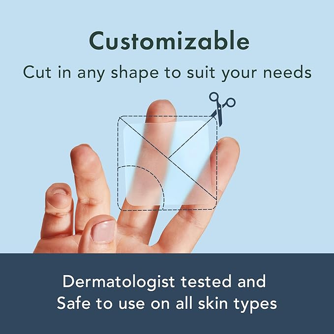 Rael Pimple Patches, Miracle XL Spot Control Cover - Hydrocolloid Acne Patch for Face, Zits & Blemish, Back and Body, Korean Skin Care (8 Count, Pack of 1)