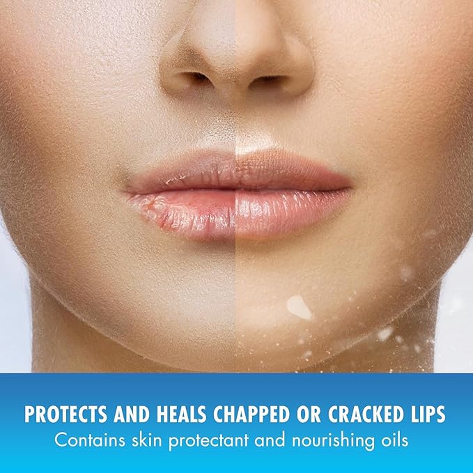 Natural Ice Medicated Lip Protect SPF Pkgs
