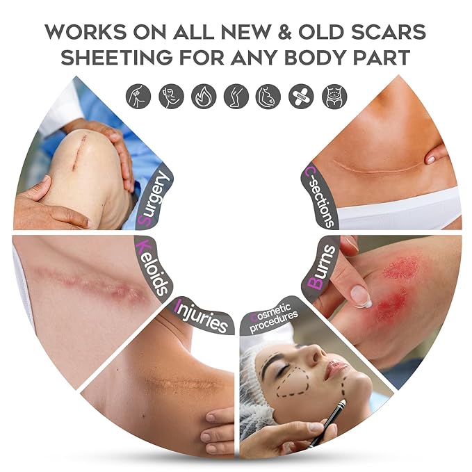 Advanced Scar Cream, 1.7 Oz(50ml) Large