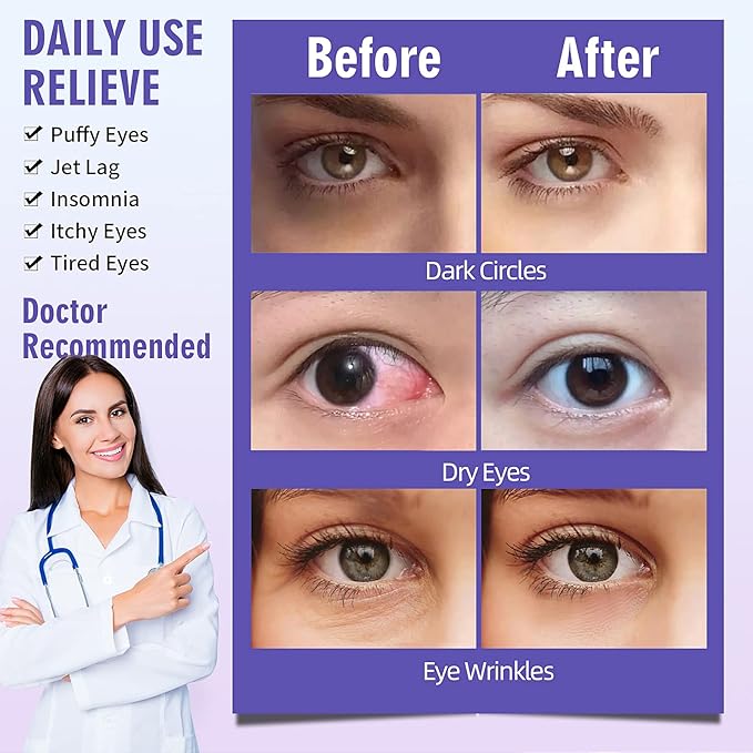 Serfeymi 10 packs steam eye