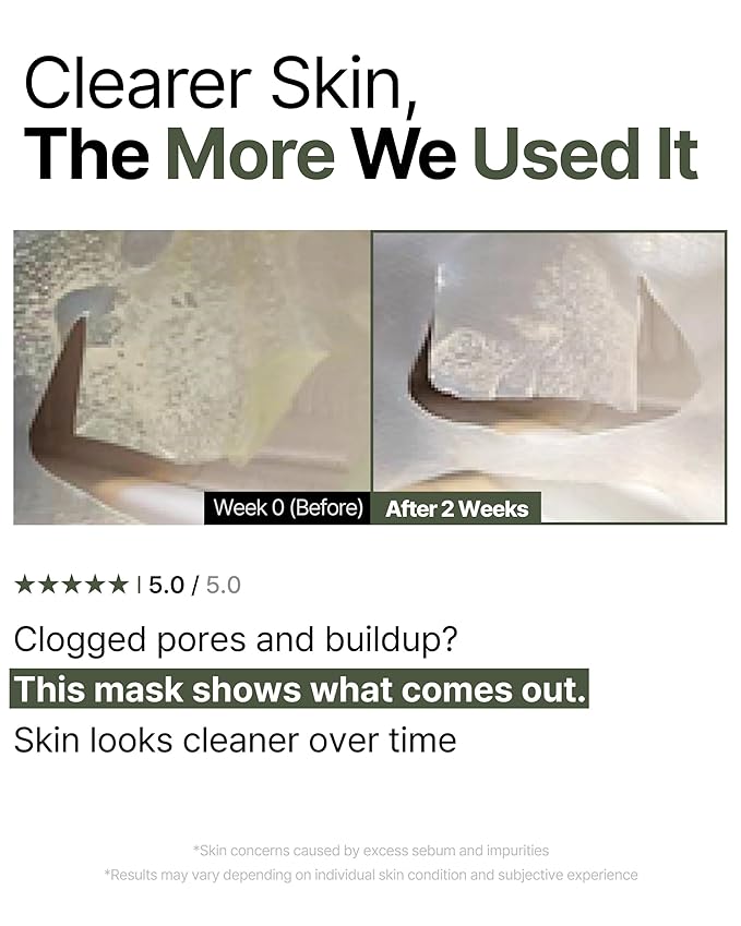 Trouble Patch Mask – Hydrating & Clarifying Korean Sheet Mask with Tea Tree Biome, Pore Vacuum Effect for Sebum & Oil Control, Calming Microbiome Skincare, Stocking Stuffer for Teens | 20ml x 4ea