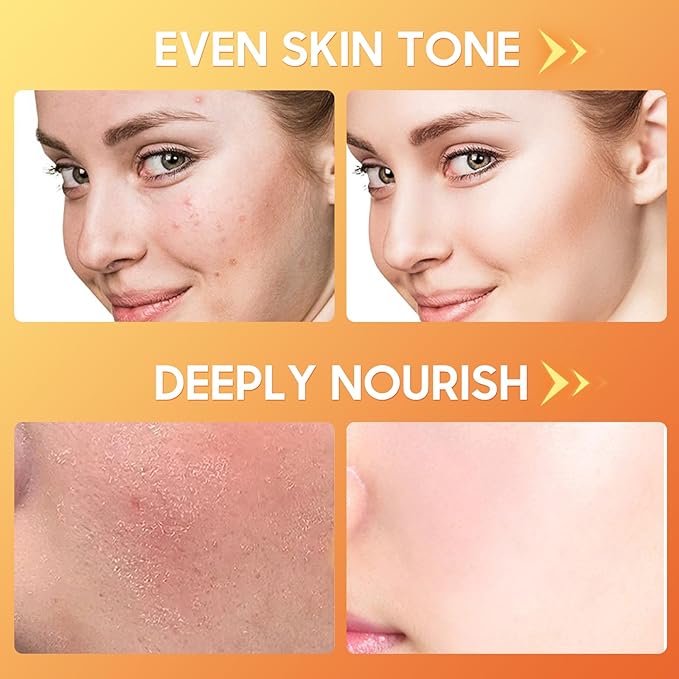 6 Pcs -Vitamin C Skincare Set for Face - with Cleanser, Serum, Eye Cream, Moisturizer, Sunscreen & Toner | Brightening, Hydrating& Anti-Aging,Perfect for Teens & Girls,Moisturizing Face Skin Care Kit