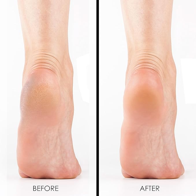 DeEnti Six Pack Bundle, Bundle