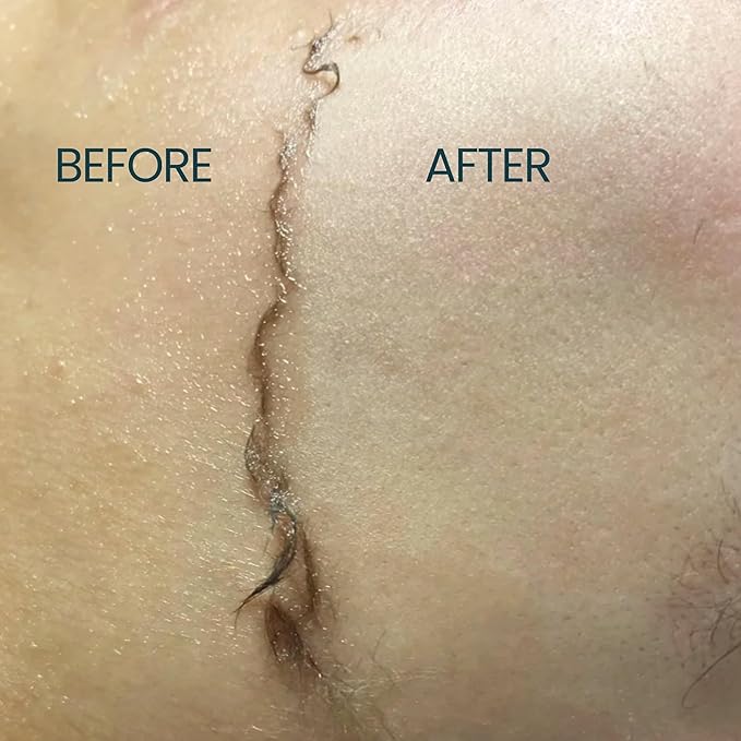 Dermaplane Oil for Women with Sensitive Skin - Face Shaving Oil - Non Comedogenic, Fragrance Free, Natural & Lightweight - Use with Dermaplane Razor for Women Face, 2oz by Ouiloe