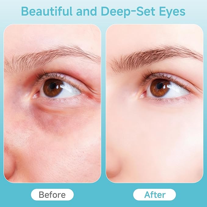 Eye Care Wand, Cold and Hot Skincare Treatment,Face Roller and Eye Massager for Eye Puffiness,Dark Circles and Glow; Depuffing Wand,Facial Skin Care Tools for Women Men (White)