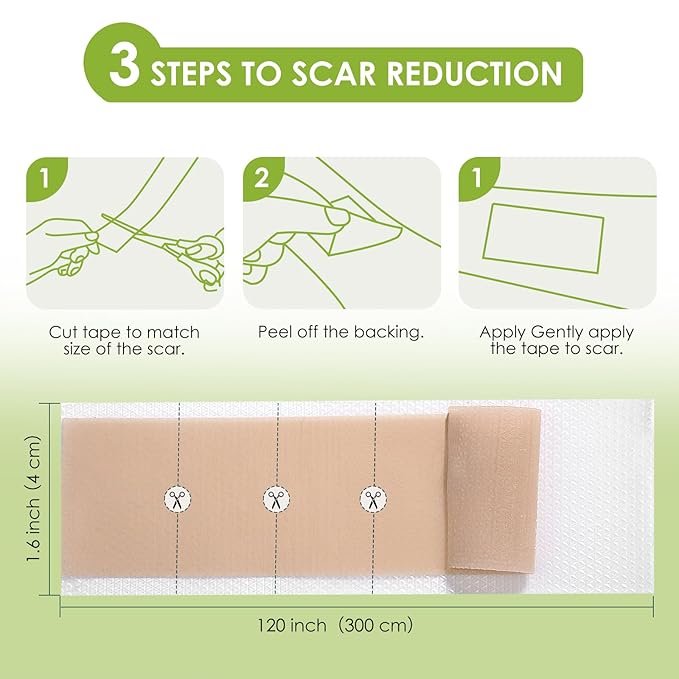 AUSLKA Silicone Scar Sheets(1.6"x 120" Roll-3M),