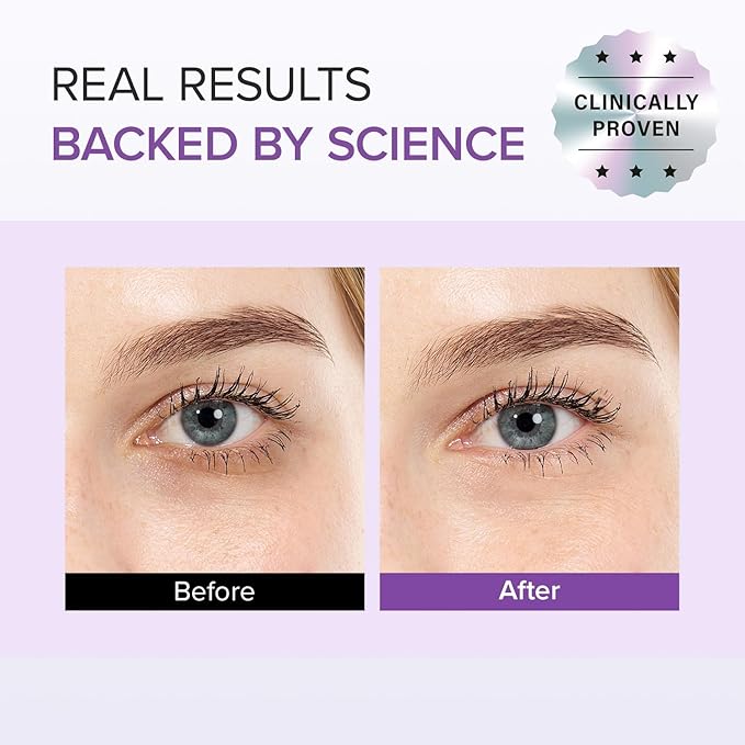 Mary&May Tranexamic Acid (TXA)+Glutathione Eye Cream | Dark Circles & Hyperpigmentation | With Niacinamide & Vitamin C | Firms Under Eye Area | Wrinkle & Fine Line Care | Korean Skincare, 1.01 oz.