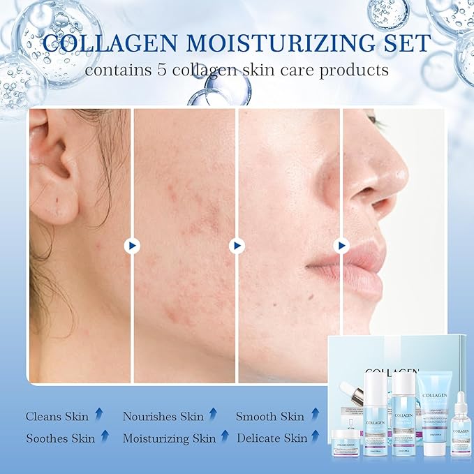 Collagen Skin Care Sets, 5 Pcs Facial Set for Skin Care for Women with Cleanser, Serum, Toner, Lotion & Cream, for Firming Skin, Reduce Wrinkles AOPEIBOTO