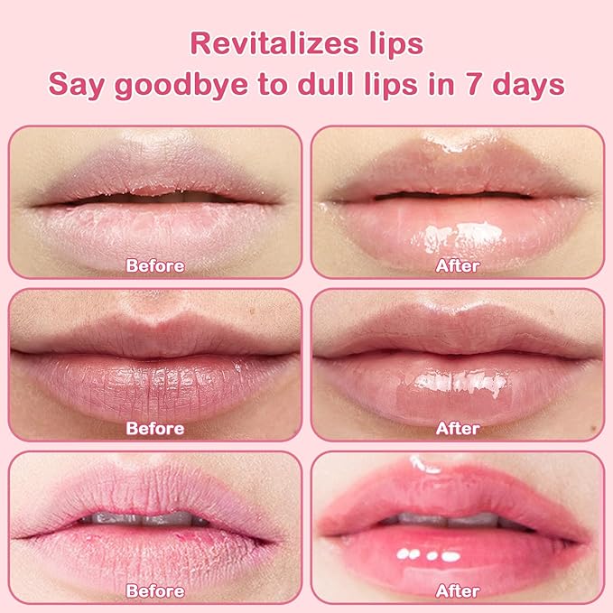 4 PCS Bee Lip Balm Honey Pot Lip Mask & Lip Scrub Set, Strawberry Watermelon Coconut Cherry Overnight Propolis Moisturizing Lip Balm Hydrating Prevention Dry and Crack Lip Exfoliator Lip Wrinkle Care