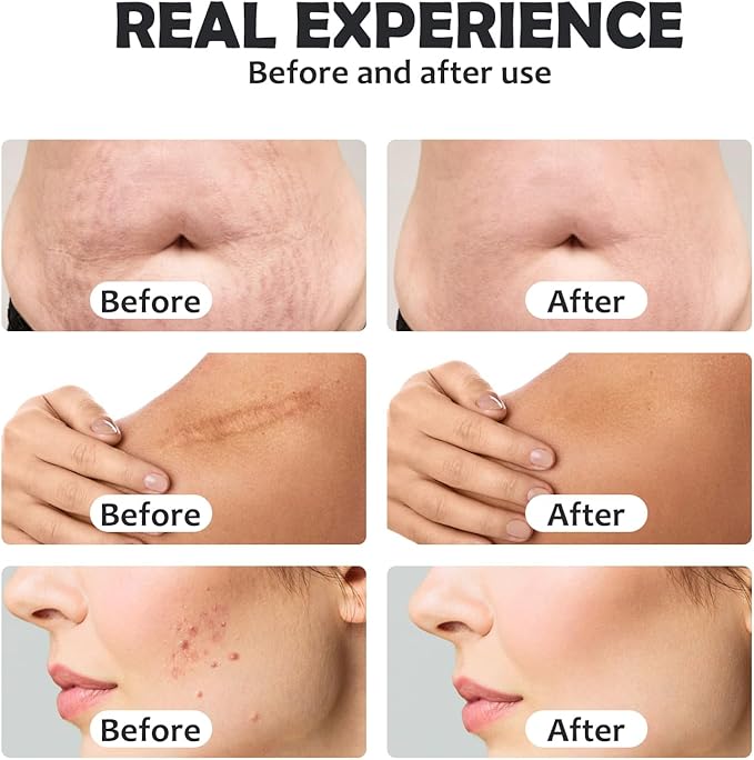 2 in 1 Portable Multifunctional Facial Care Salon Beauty Equipment Professional Anti-Aging Machine