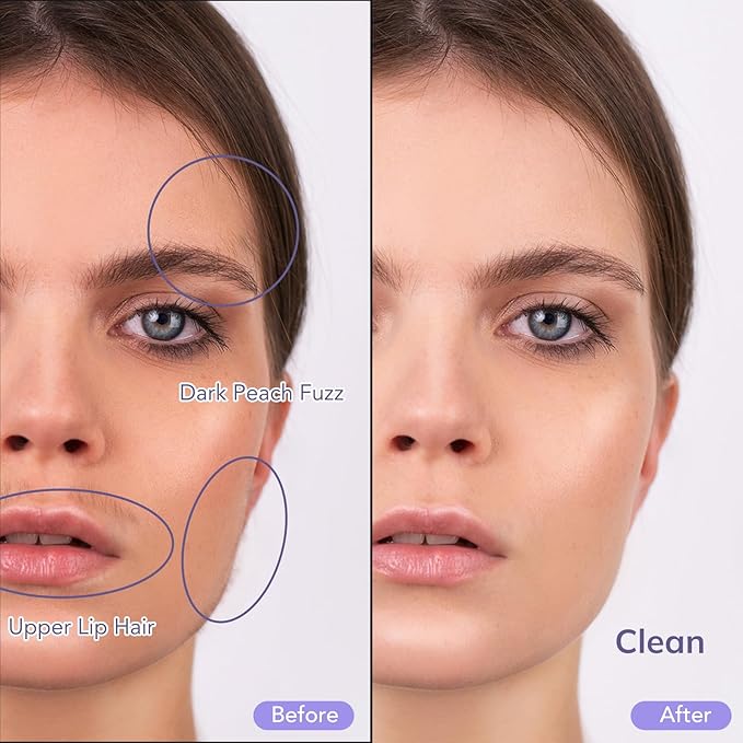 PELCAS Electric Dermaplaning Tool for Women Face with LED Light 3 Speeds Mini Dermaplaning Razor with 6 Blades, 2 in 1 Facial Peach Fuzz Hair & Exfoliation Removal System At Home BV18-712 Light Purple