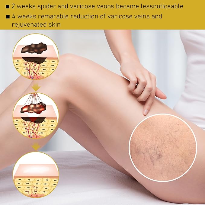 2pc Bee Venom Face Cream - Reduce Blemishes, All-Natural Formula