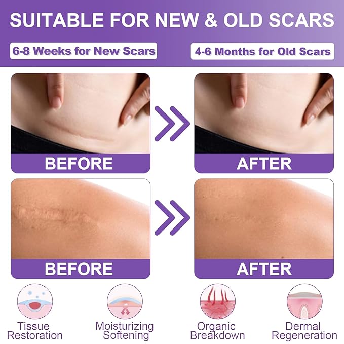 Silicone Scar Sheets, Medical Grade Silicone