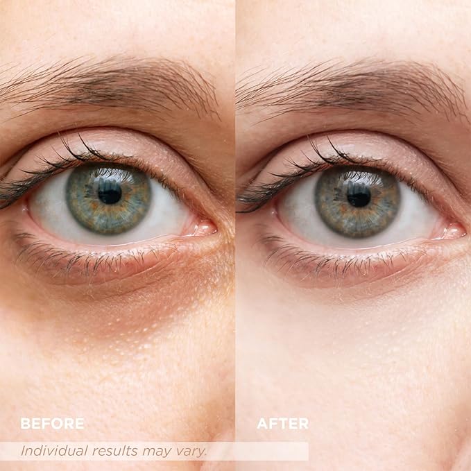 VELAMO ADVANCED Luminous Eye Corrector SPF 41: Under Eye Color Corrector for Dark Circles, Fine Lines & Puffiness - Hydrating Anti Aging Eye Cream with Ceramides Complex - Medium, 0.34 FL OZ/10mL 2Pcs