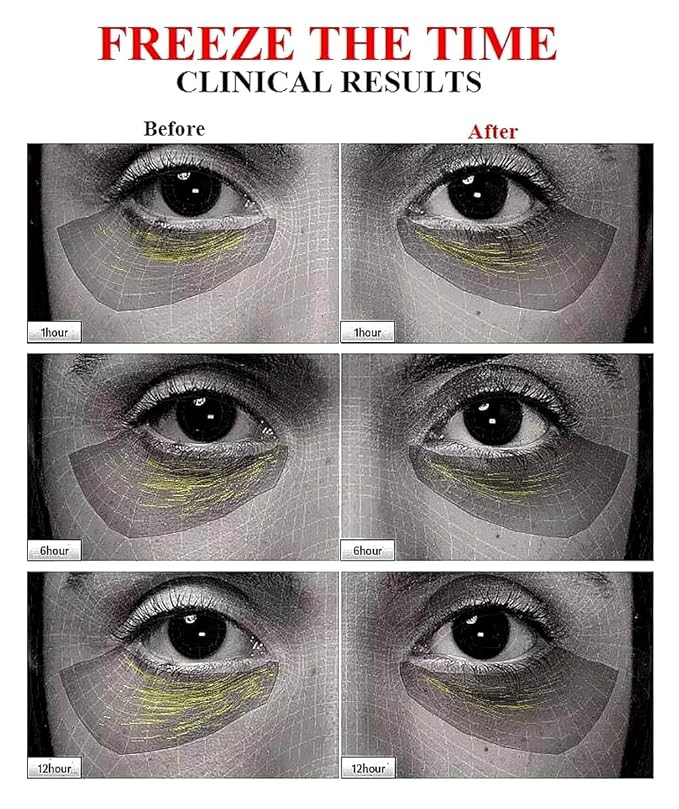 (85%) Human Stem Cell & (10%) PDRN Anti-Aging & Repair Ampoule Serum (12 Vials, 120ml) for Youthful, Radiant Skin!