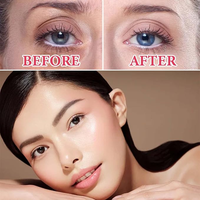 Retinol Eye Cream for Dark Circles and Puffiness,Under Eye Cream with Collagen & Hyaluronic Acid,Fix Wrinkle,Lightweight Lift Eye Cream,Brighten Tighten Eye Cream Gel to Smooth Fine Lines & Hydrate